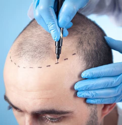 patient-suffering-from-hair patient-suffering-from-hair